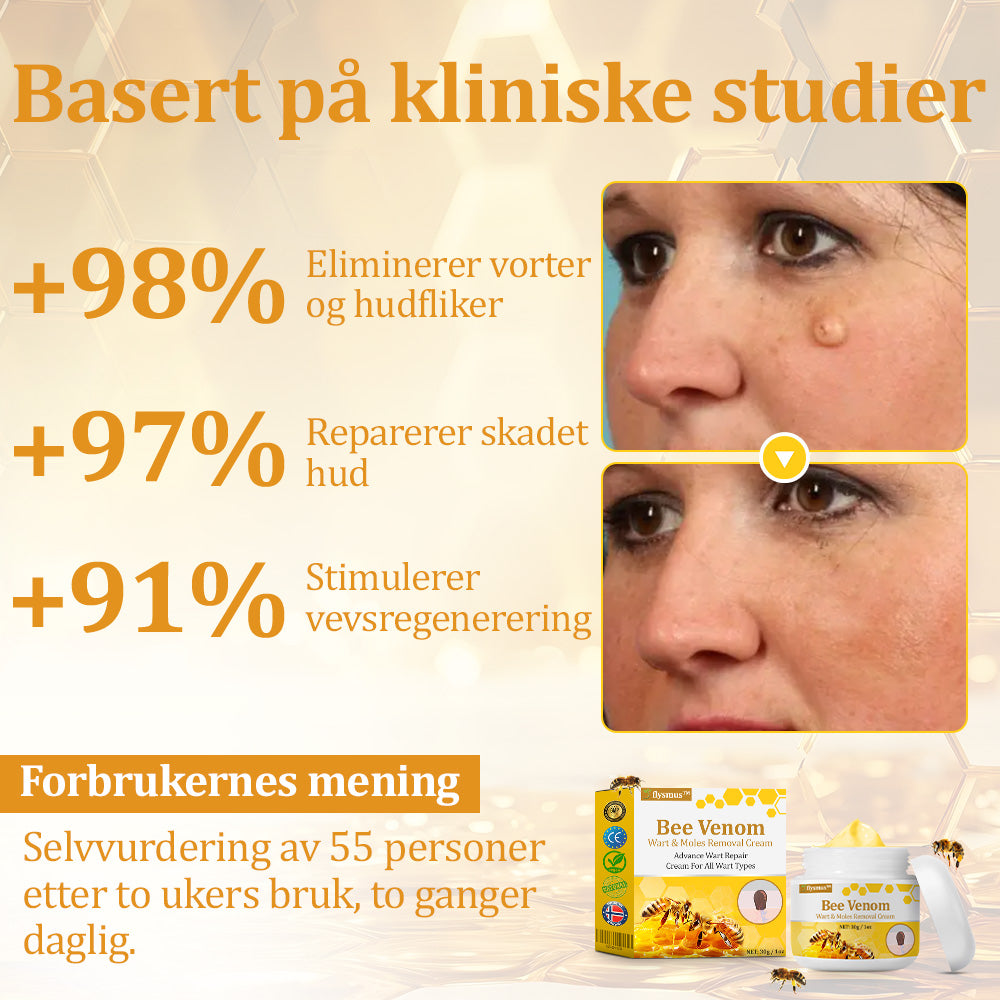 🐝flysmus™ Bievenom vorte- og føflekkfjerningskrem, sertifisert av Statens legemiddelverk (NoMA)💖✅