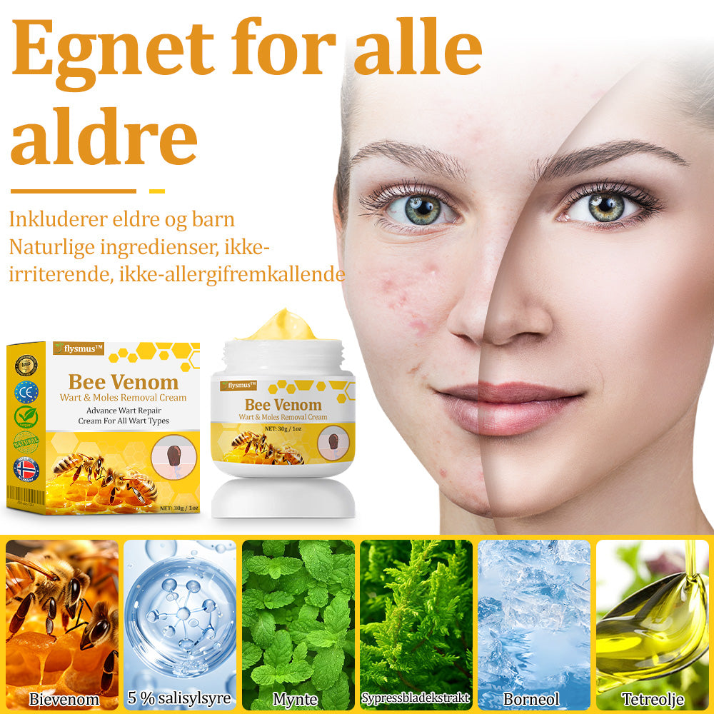 🐝flysmus™ Bievenom vorte- og føflekkfjerningskrem, sertifisert av Statens legemiddelverk (NoMA)💖✅