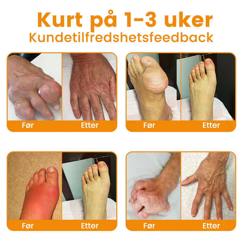 💖Ourlyard™ Magnesiumolje og Bievenn Leddsmertespray👨⚕️Godkjent av Norsk Ortopedisk Forening (NOF)