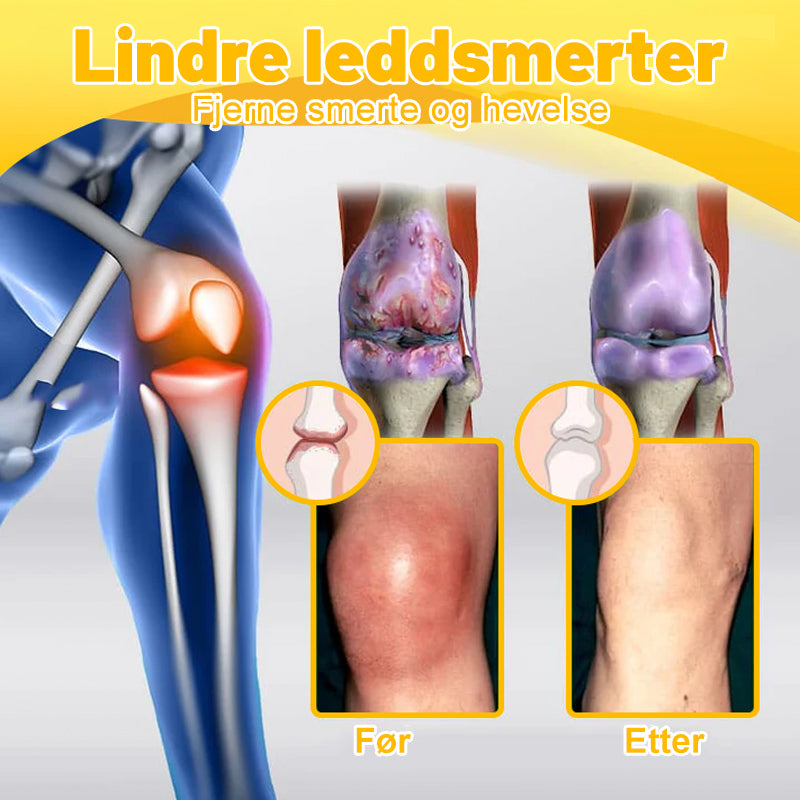 💖Ourlyard™ Magnesiumolje og Bievenn Leddsmertespray👨⚕️Godkjent av Norsk Ortopedisk Forening (NOF)