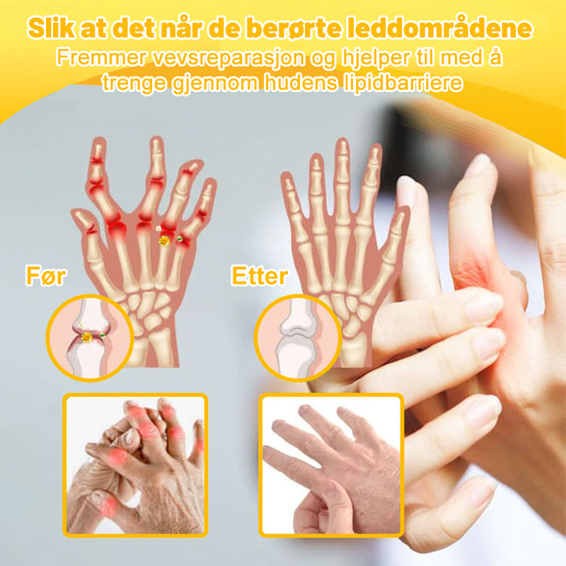 💖Ourlyard™ Magnesiumolje og Bievenn Leddsmertespray👨⚕️Godkjent av Norsk Ortopedisk Forening (NOF)