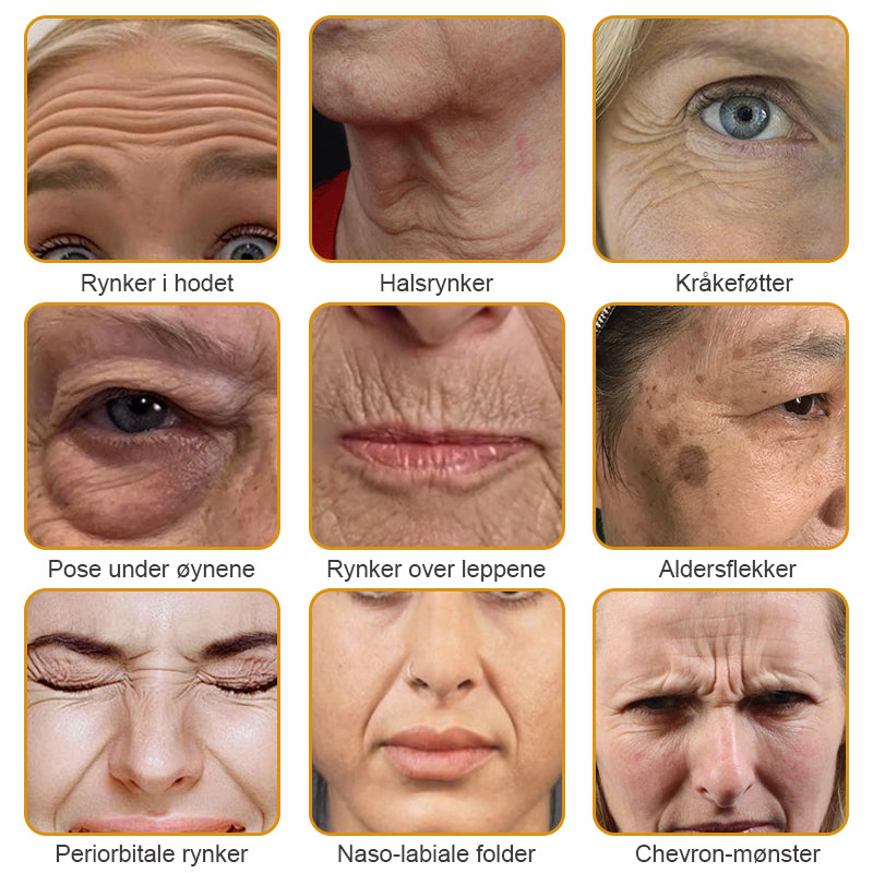 🫎🎀Laget og sendt fra Norge ✅ Furzero™ Botox Bee Venom Rynkefjerningskrem - Siste dag kampanje 70 % AVSLAG