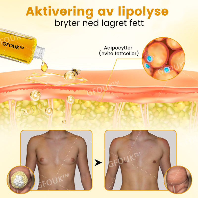 GFOUK™ ThermoFirm Biegift Gynekomasti Olje