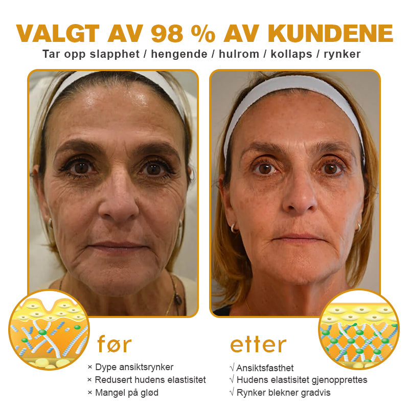 🫎🎀Laget og sendt fra Norge ✅ Furzero™ Botox Bee Venom Rynkefjerningskrem - Siste dag kampanje 70 % AVSLAG