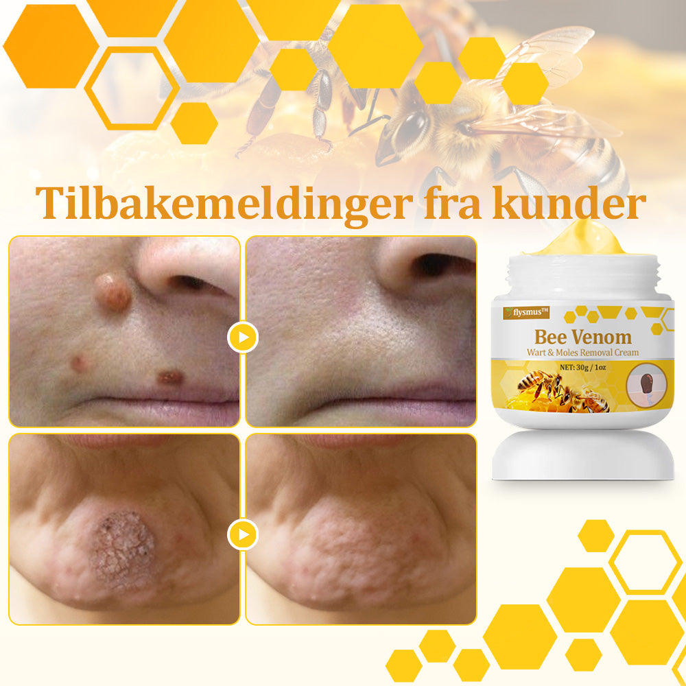 🐝flysmus™ Bievenom vorte- og føflekkfjerningskrem, sertifisert av Statens legemiddelverk (NoMA)💖✅