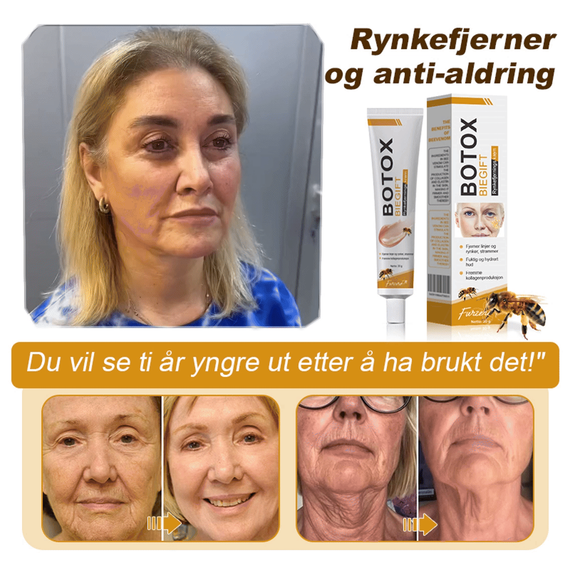 🫎🎀Laget og sendt fra Norge ✅ Furzero™ Botox Bee Venom Rynkefjerningskrem - Siste dag kampanje 70 % AVSLAG