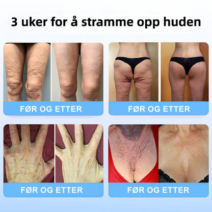 🌲💖Flysmus™ Kollagen Peptider OPPSTREKKENDE SERUMSTIKK