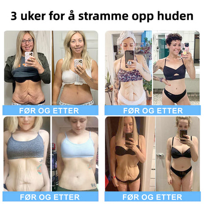 🌲💖Flysmus™ Kollagen Peptider OPPSTREKKENDE SERUMSTIKK