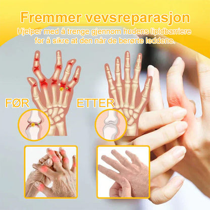 ✅ Offisiell butikk: flysmus™ Bee Venom Smertelindrende Beinhelingskrem 👨‍⚕️ Godkjent av Norsk Ortopedisk Forening (NOF) (Lindrer leddsmerter, hevelse, stivhet, rødhet, varme, ømhet og leddutmattelse)