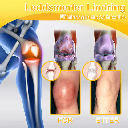 ✅ Offisiell butikk: flysmus™ Bee Venom Smertelindrende Beinhelingskrem 👨‍⚕️ Godkjent av Norsk Ortopedisk Forening (NOF) (Lindrer leddsmerter, hevelse, stivhet, rødhet, varme, ømhet og leddutmattelse)