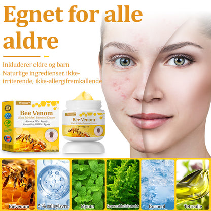 🐝flysmus™ Bievenom vorte- og føflekkfjerningskrem, sertifisert av Statens legemiddelverk (NoMA)💖✅