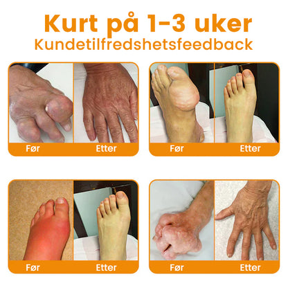 💖Ourlyard™ Magnesiumolje og Bievenn Leddsmertespray👨‍⚕️Godkjent av Norsk Ortopedisk Forening (NOF)