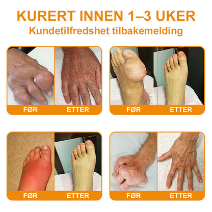 ✅ Offisiell butikk: flysmus™ Bee Venom Smertelindrende Beinhelingskrem 👨‍⚕️ Godkjent av Norsk Ortopedisk Forening (NOF) (Lindrer leddsmerter, hevelse, stivhet, rødhet, varme, ømhet og leddutmattelse)