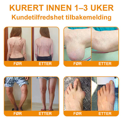 ✅ Offisiell butikk: flysmus™ Bee Venom Smertelindrende Beinhelingskrem 👨‍⚕️ Godkjent av Norsk Ortopedisk Forening (NOF) (Lindrer leddsmerter, hevelse, stivhet, rødhet, varme, ømhet og leddutmattelse)