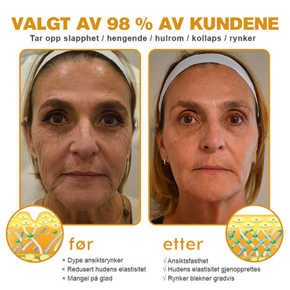 🫎🎀Laget og sendt fra Norge ✅ Furzero™ Botox Bee Venom Rynkefjerningskrem - Siste dag kampanje 70 % AVSLAG