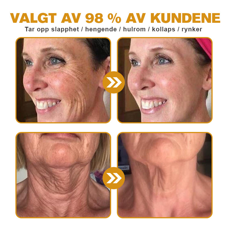 🫎🎀Laget og sendt fra Norge ✅ Furzero™ Botox Bee Venom Rynkefjerningskrem - Siste dag kampanje 70 % AVSLAG