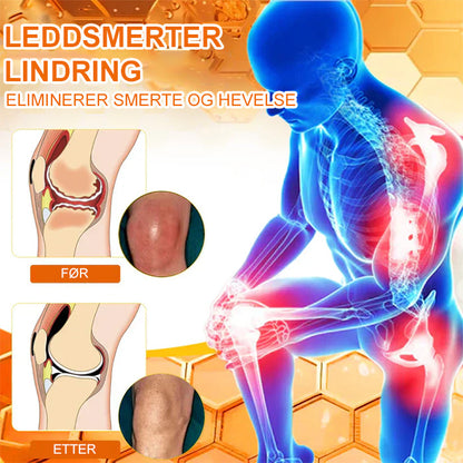 ✅ Offisiell butikk: flysmus™ Bee Venom Smertelindrende Beinhelingskrem 👨‍⚕️ Godkjent av Norsk Ortopedisk Forening (NOF) (Lindrer leddsmerter, hevelse, stivhet, rødhet, varme, ømhet og leddutmattelse)