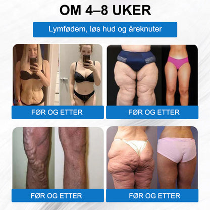 ⚖️🐙【Siste dags tilbud -60 %🌟】🌈🌈ZVOEVO® SMGT-GLP-1 Tirzenti & Kollagen Nano-Mikronål Slankepatch丨Rettet mot fedme, slapp hud, høyt blodtrykk, diabetes, fettlever, leddsmerter og tretthet