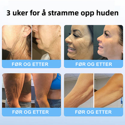 🌲💖Flysmus™ Kollagen Peptider OPPSTREKKENDE SERUMSTIKK